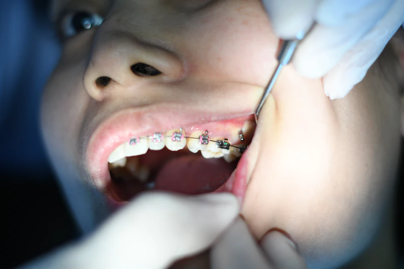 A close view of teeth with metal braces